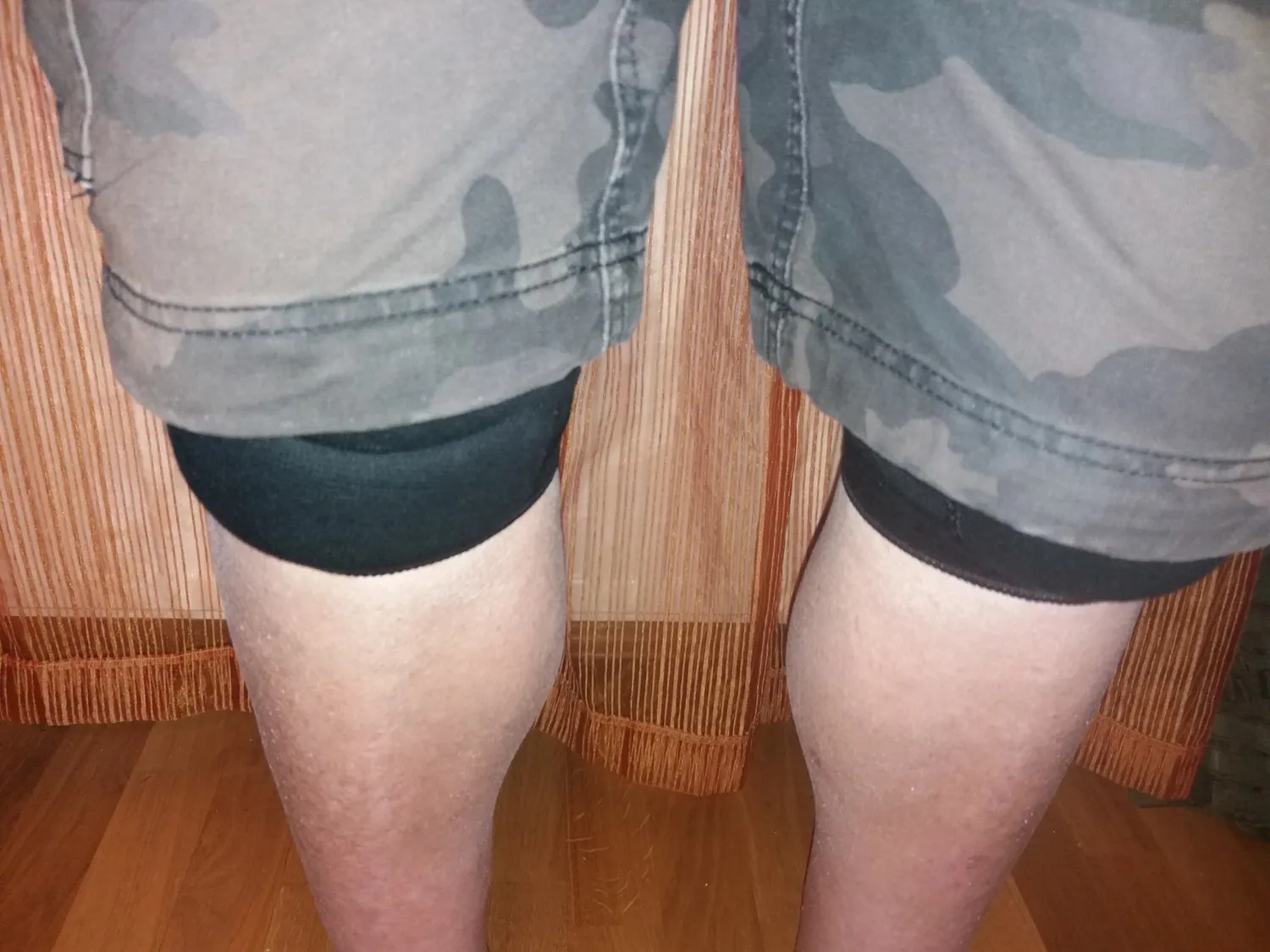 MoKo Ginocchiera Elastica Sportiva Nera Traspirante